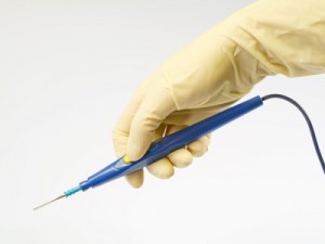 surgeon holding a blue electric scalpel